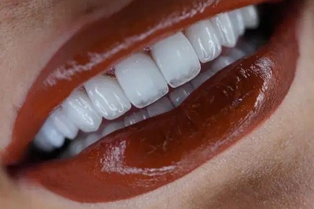 کلینیک دندانپزشکی حامی با اقساط ۳۶ ماهه تا ۱۵ خرداد