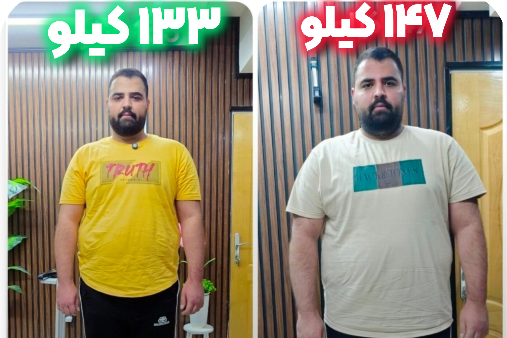 ۱۴ کیلو لاغری در یکماه با اسلیو معده بدون جراحی/
مطب لاغری وحید خانی در تهران