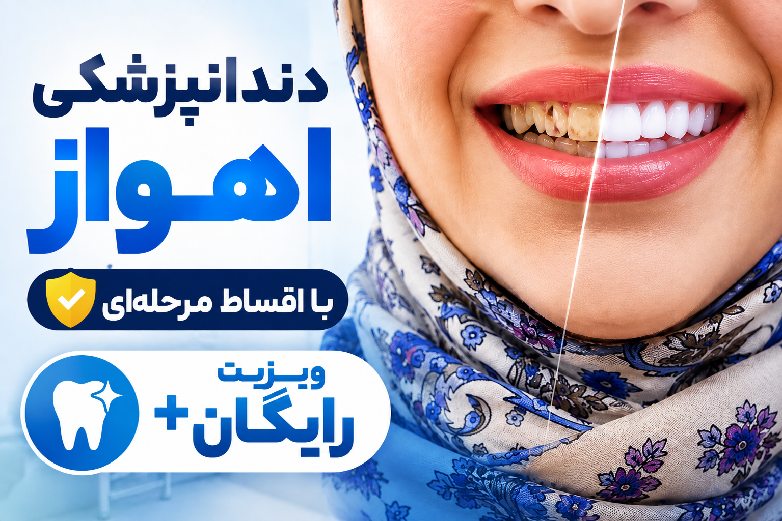 دندانپزشکی اهواز با اقساط مرحله ای و ویزیت رایگان . در اهواز