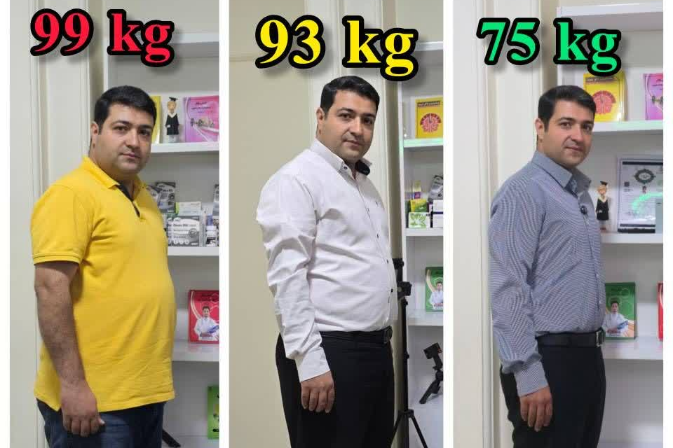 24 کیلو لاغری سریع با اسلیومعده بدون جراحی/لاغری با وحید خانی در تهران